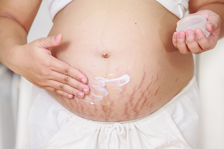 thai nhi tuần 21 có thể làm mẹ bị rạn da bụng