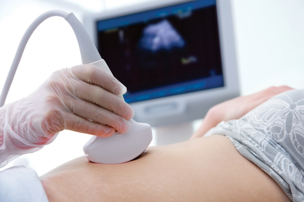 Mang thai tháng thứ 2: Mẹ nên có lần siêu âm thai đầu tiên